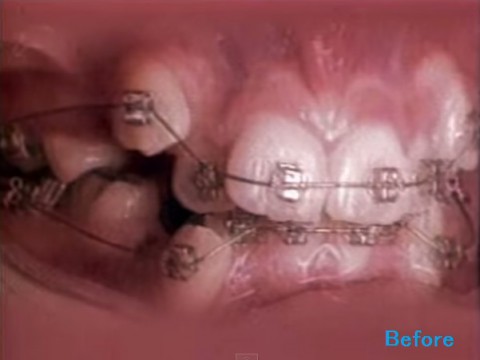 orthodontics02
